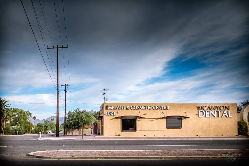 Canyon Dental Group: Karen Randall, DDS | 4001 E Broadway Blvd, Tucson, AZ 85711, USA | Phone: (520) 323-2600