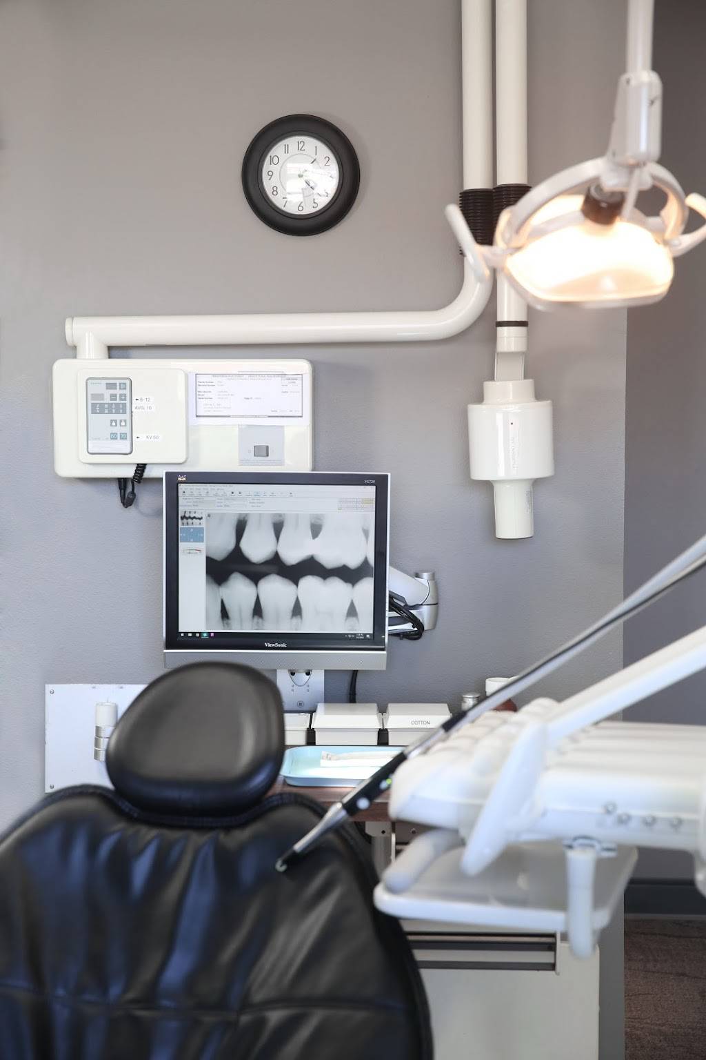 Cary Dental - Sherwood | 20015 SW Pacific Hwy UNIT 220, Sherwood, OR 97140, USA | Phone: (503) 925-9992