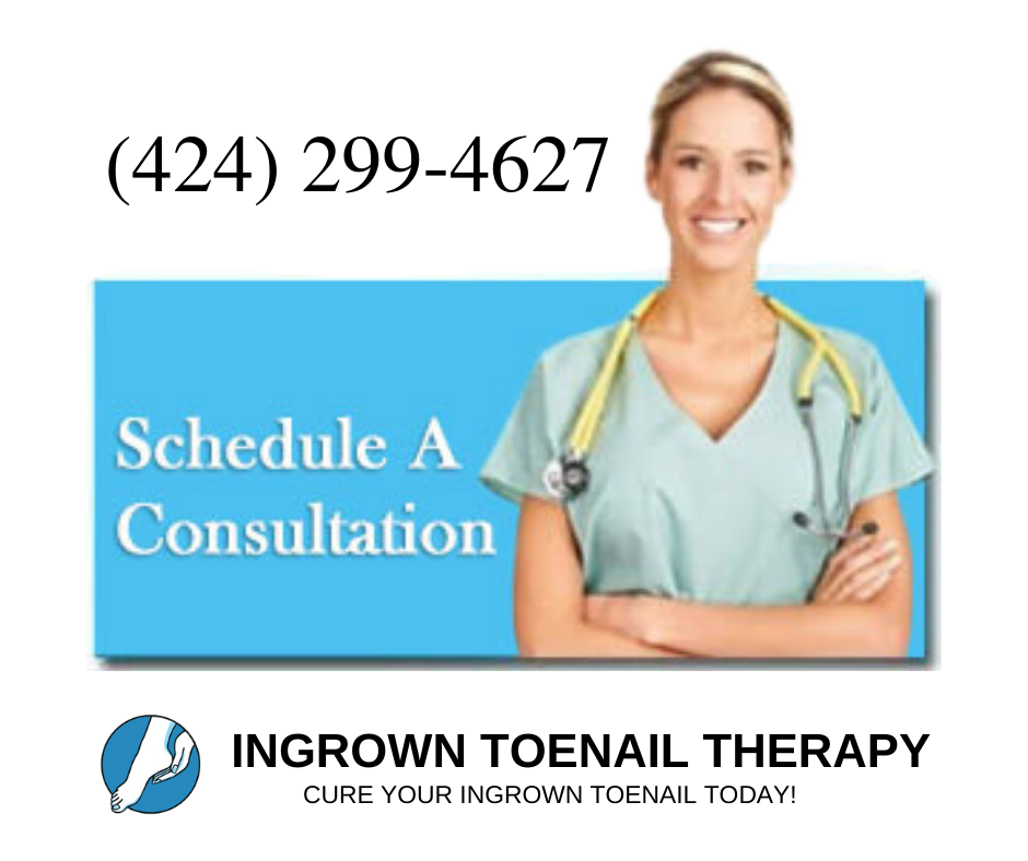 Ingrown Toenail Treatment in Toenail Fungus Treatment Center | 1576 Bloomingdale Ave, Valrico, FL 33596 | Phone: (424) 299-4627