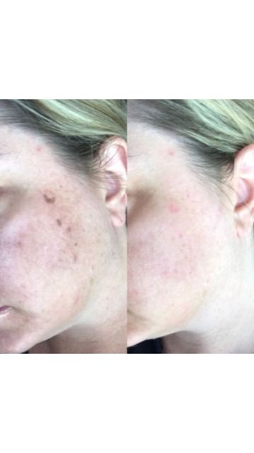 Skin Magic | 8880 E Vía Linda #107, Scottsdale, AZ 85258, USA | Phone: (480) 338-8370