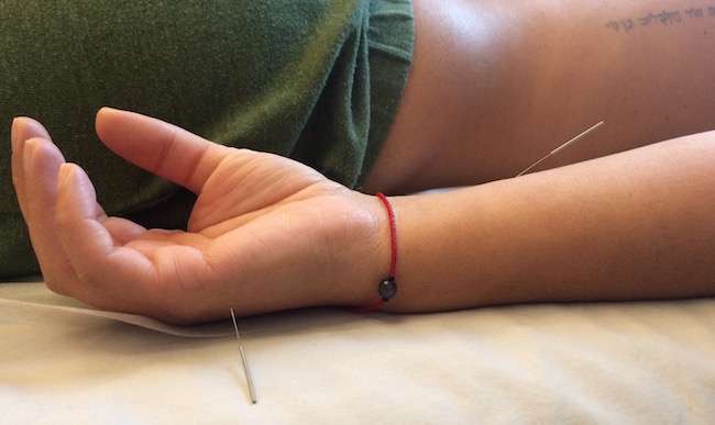 Acupuncture Atelier | 1321 Washington St #2b, Hoboken, NJ 07030, USA | Phone: (201) 708-8577