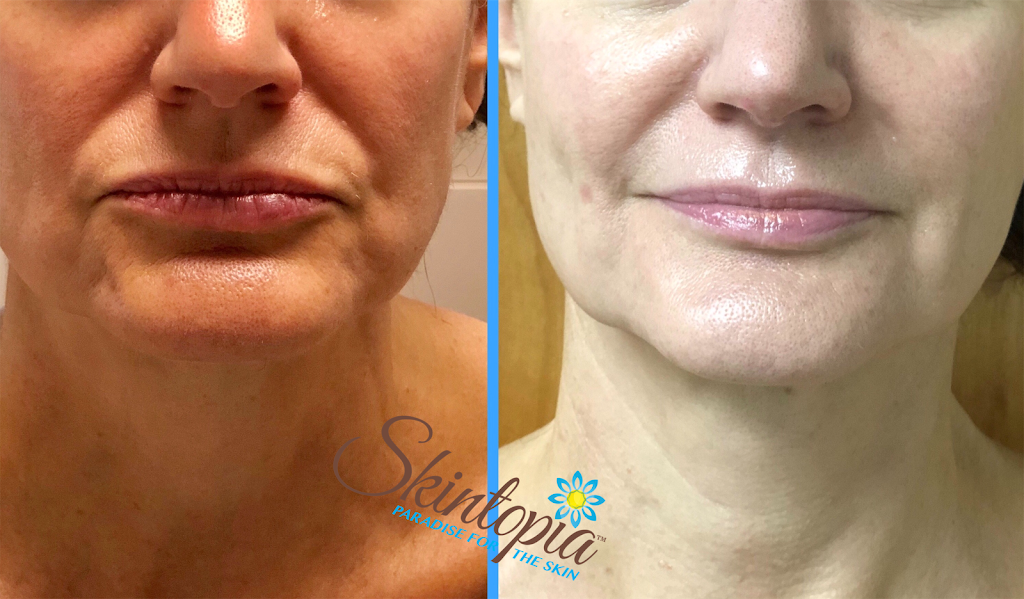 Skintopia | 3301 N Miller Rd Suite 138, Scottsdale, AZ 85251, USA | Phone: (480) 375-5072