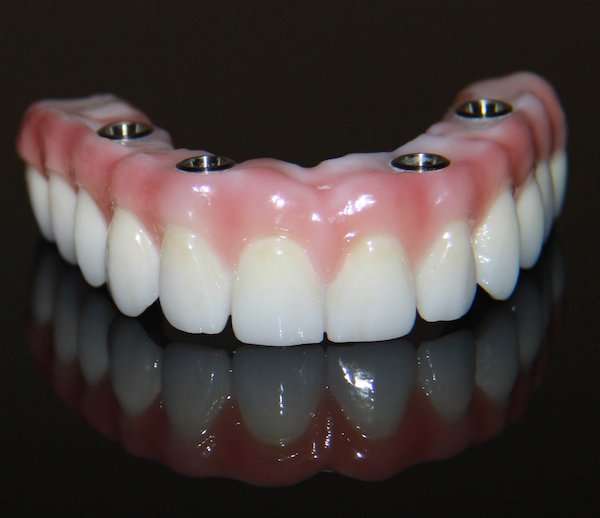 Lifetime Teeth Today: Dental Implant Center-Orlando Area | 158 Lookout Pl #101, Maitland, FL 32751, USA | Phone: (407) 814-4941