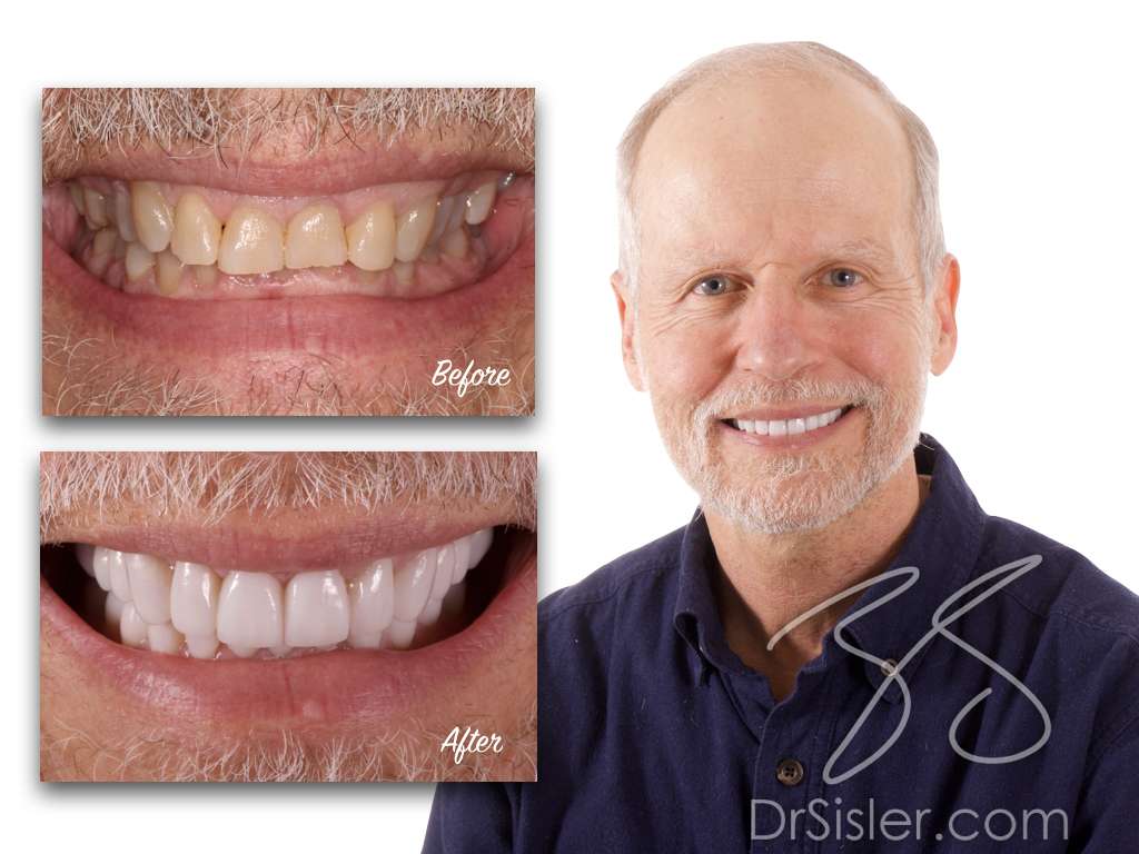 Smile Design by Sisler | 1020 Orrstown Rd, Shippensburg, PA 17257, USA | Phone: (717) 532-8740