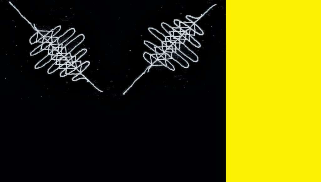 -----ZERO OHM RESISTOR----- | 2938 E Laurel Ln, Phoenix, AZ 85028, USA