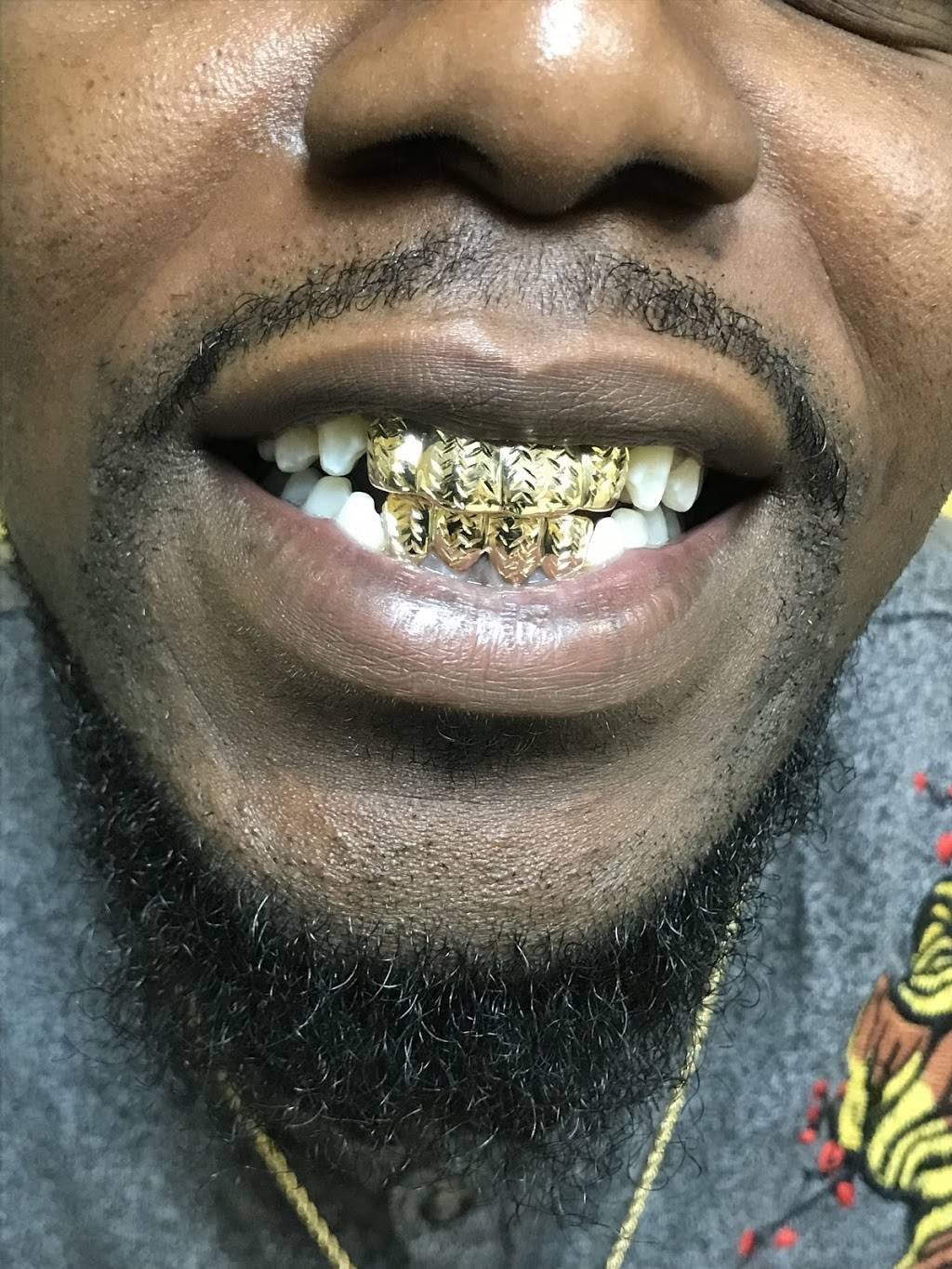 Mesa Gold Grillz LLC | 1731 W Baseline Rd #112, Mesa, AZ 85202, USA | Phone: (855) 290-4653