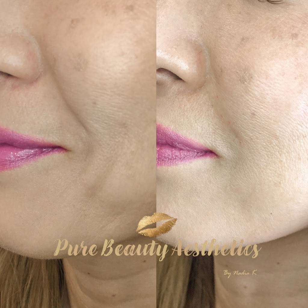 Pure Beauty Aesthetics | 2985 S Meridian Rd Suite 120, Meridian, ID 83642, USA | Phone: (208) 514-7255