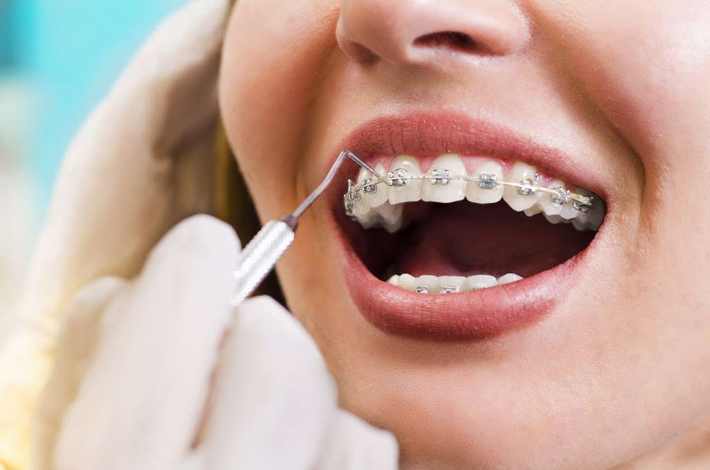 Cochran Orthodontics | 2246 SE Military Dr, San Antonio, TX 78223, USA | Phone: (210) 714-5525