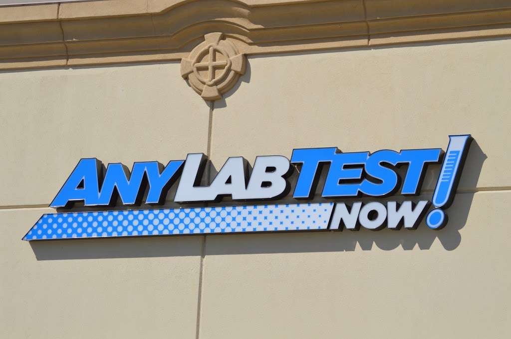 any lab test now sugar land