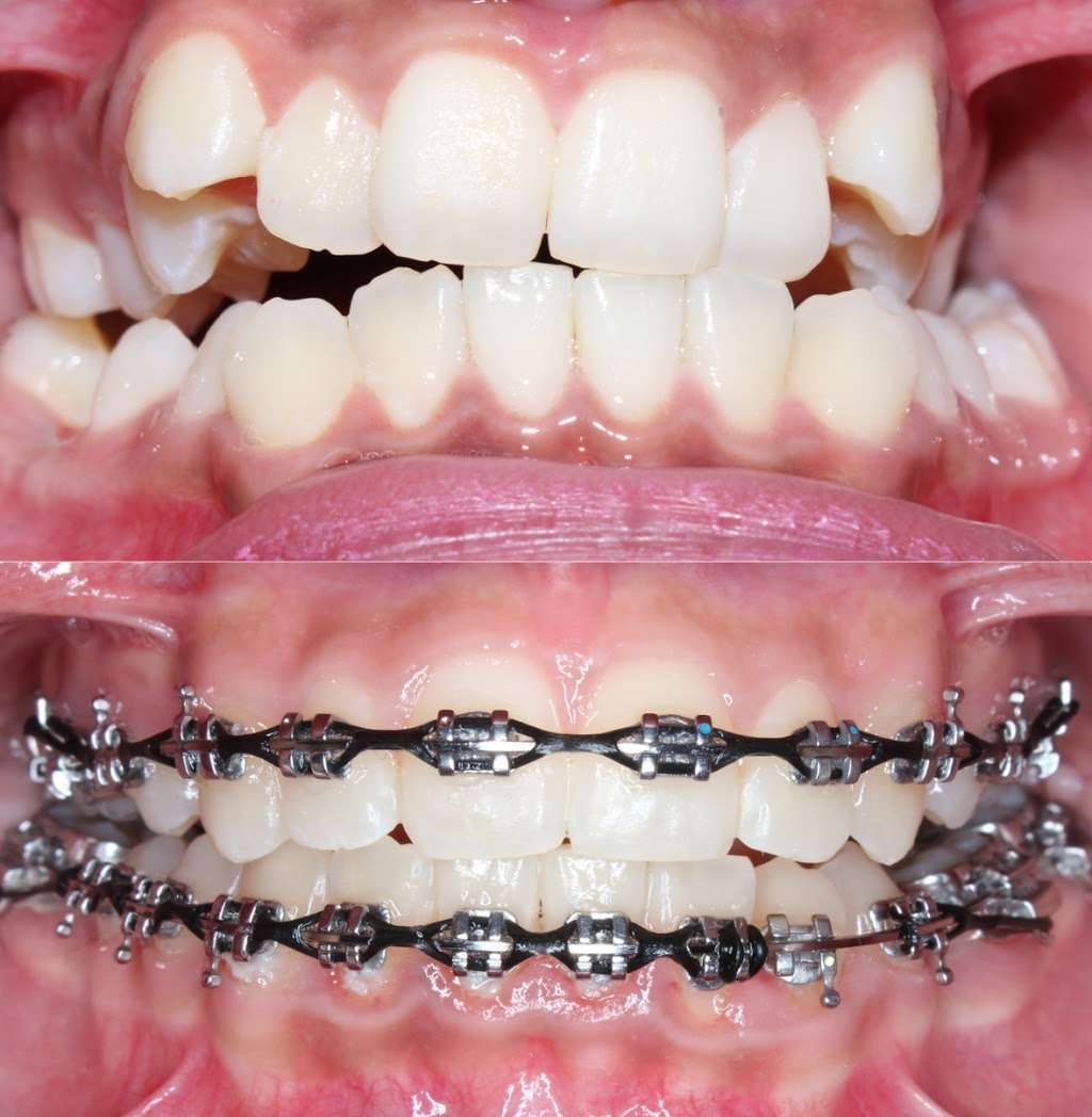 Alamo Ranch Orthodontics | 5616 Lone Star Pkwy #104, San Antonio, TX 78253, USA | Phone: (210) 920-4930 Alamo Ranch Orthodontics | 5616 Lone Star Pkwy #104, San Antonio, TX 78253, USA | Phone: (210) 920-4930