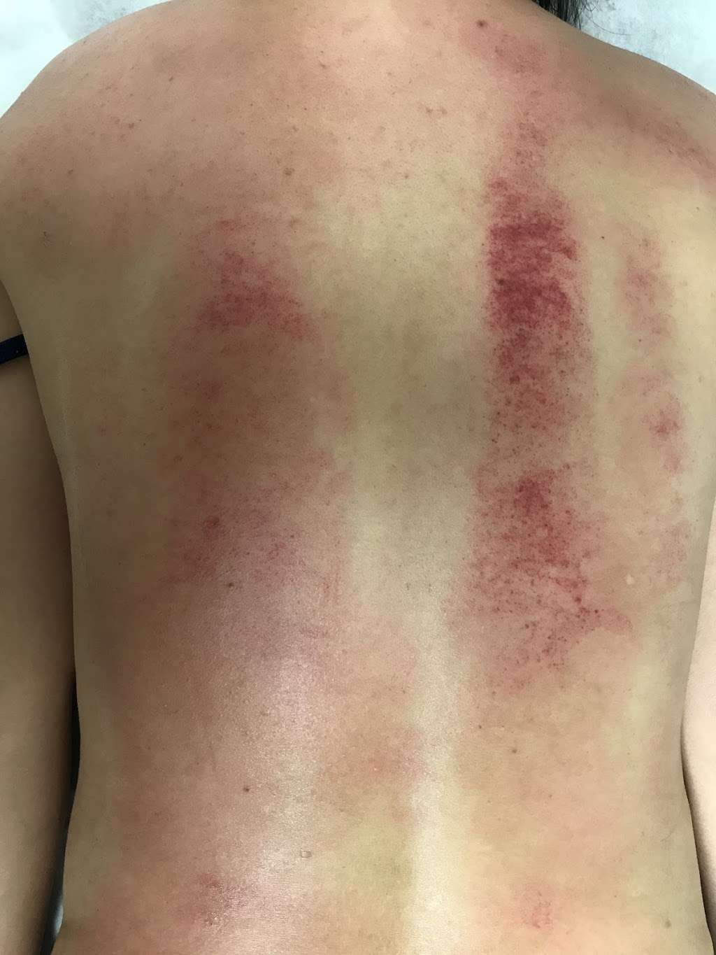 黎禧记中医针灸拔罐艾灸刮痧中药 Acupuncture cupping | 159 E LIVE OAK AVE, STE 107, ARCADIA, CA 91006, USA | Phone: (626) 205-8330