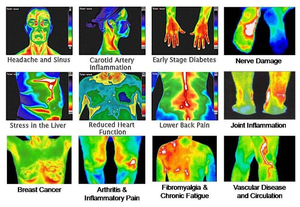 Thermography of Crosby | 118 Kernohan St, Crosby, TX 77532, USA | Phone: (281) 886-8801