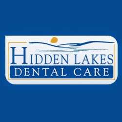 Hidden Lakes Dental Care | 680 W Boughton Rd, Bolingbrook, IL 60440, USA | Phone: (630) 759-0077