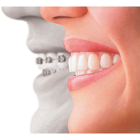 Get Clear Orthodontics | 2803 N Bogus Basin Rd, Boise, ID 83702, USA | Phone: (208) 343-1393