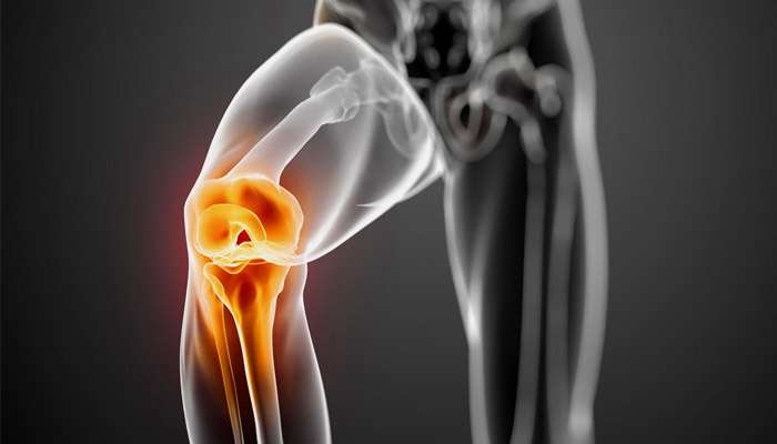 Arthritis Pain Management | 114-20 Rockaway Blvd suite 200, South Ozone Park, NY 11420, USA | Phone: (646) 647-8841