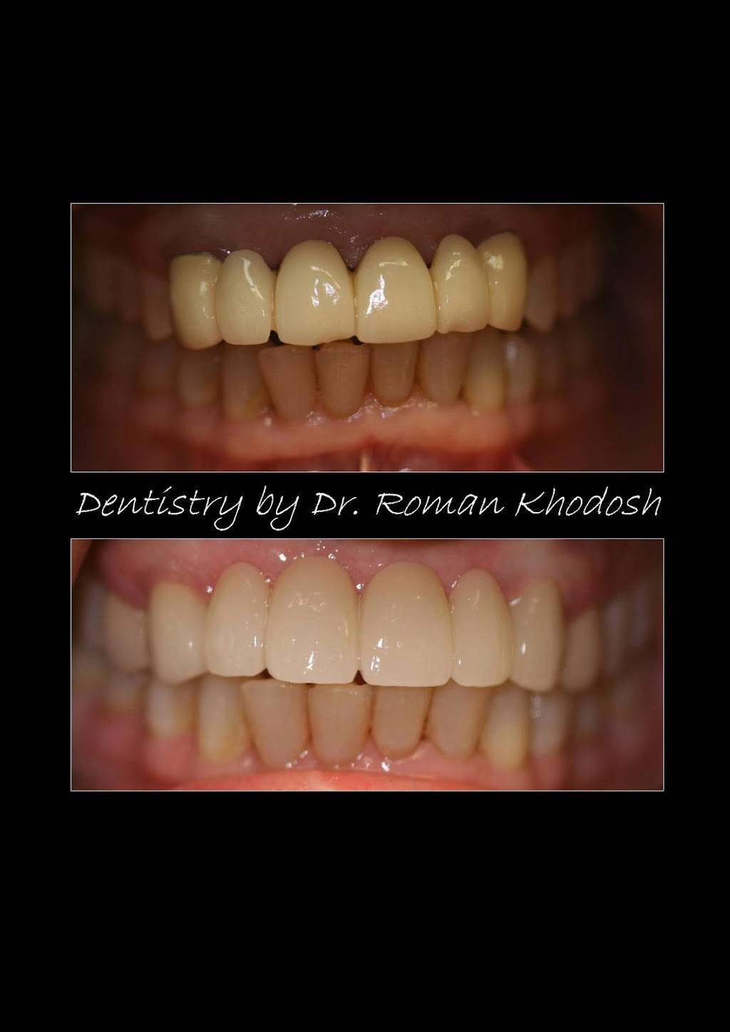 Roman Khodosh DDS PC | 275 Prospect St #1f, East Orange, NJ 07017, USA | Phone: (973) 542-7597