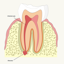 Warren R. Gase, DDS | 9294 Winton Rd, Cincinnati, OH 45231, USA | Phone: (513) 931-3001