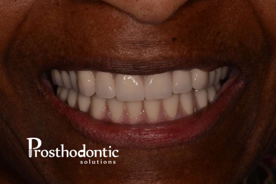 Prosthodontic Solutions-Dr. Michael Waliszewski | 19990 W Greenfield Ave, Brookfield, WI 53045, USA | Phone: (262) 787-0677