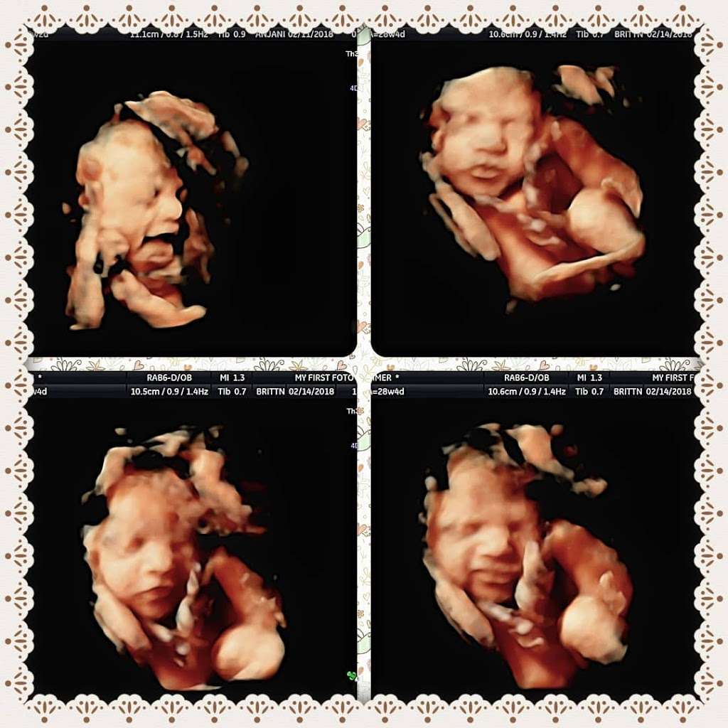 My First Foto 3D 4D Ultrasound | 10161 Bolsa Ave #205A, Westminster, CA 92683 | Phone: (714) 824-1313