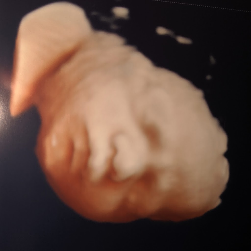 Early Images 3d 4d ultrasound | 350 Missouri Ave #103, Jeffersonville, IN 47130 | Phone: (812) 280-2229