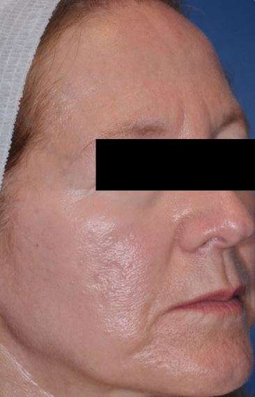 Maleva Skin Care | 18832 Norwalk Blvd, Artesia, CA 90701, USA | Phone: (562) 402-7878