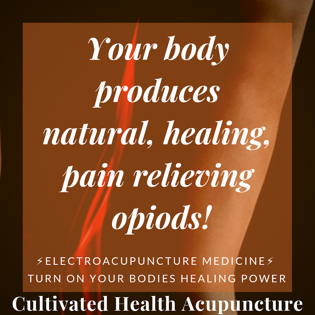 Cultivated Health Acupuncture | 400 Carlton Ave #7, Los Gatos, CA 95032 | Phone: (408) 490-0308