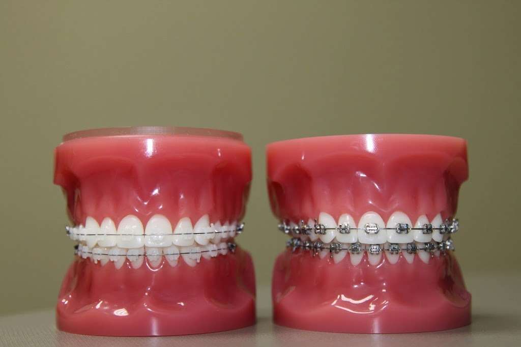 Finesse Orthodontics | 10920 Fry Rd, Cypress, TX 77433, USA | Phone: (832) 653-2141