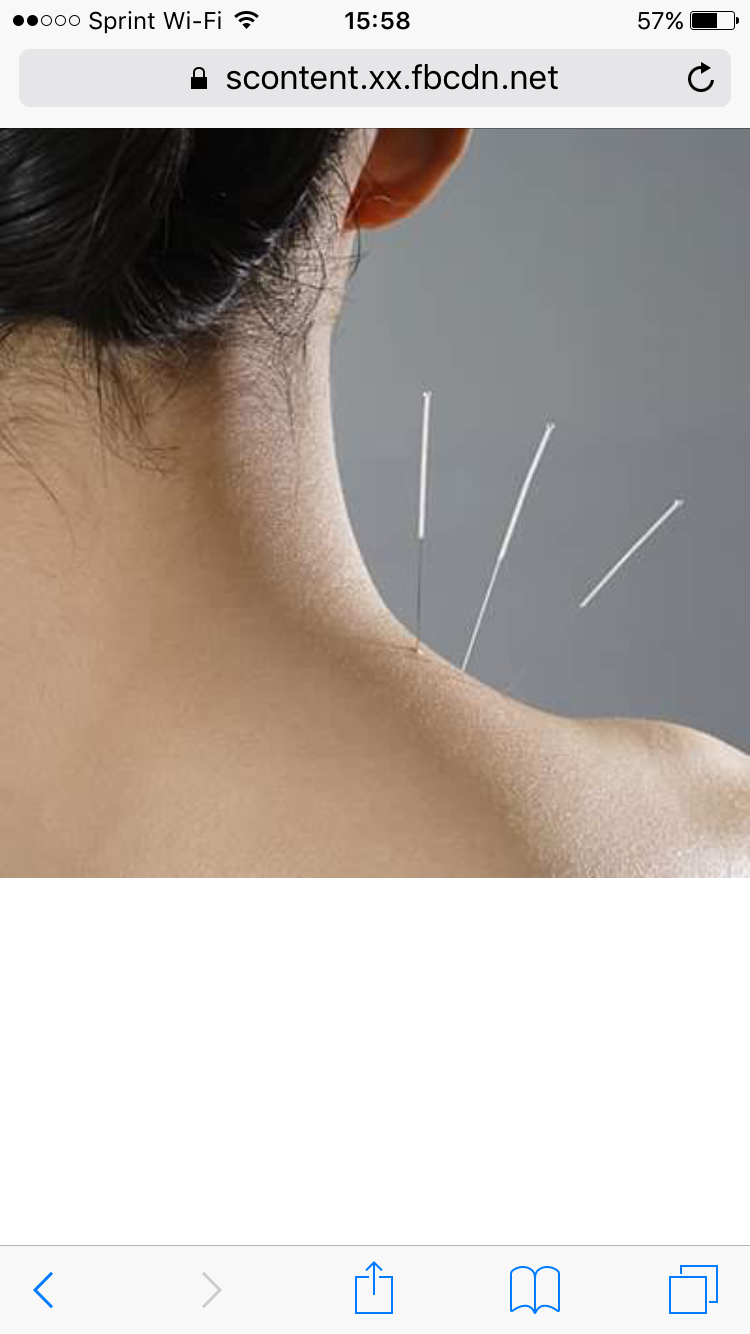 Acupuncture Body | 87 NJ-17, Maywood, NJ 07607 | Phone: (973) 798-8457