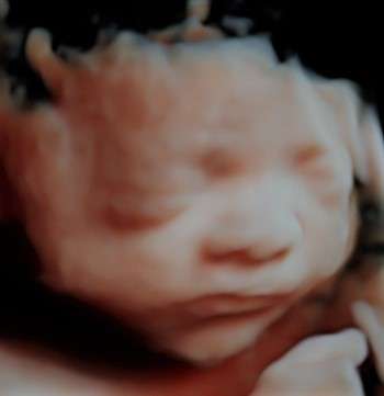 Mommy And Me 3d 4d HD Ultrasound - Westminister | 9100 W 100th Ave B1, Westminster, CO 80021, USA | Phone: (720) 584-1721