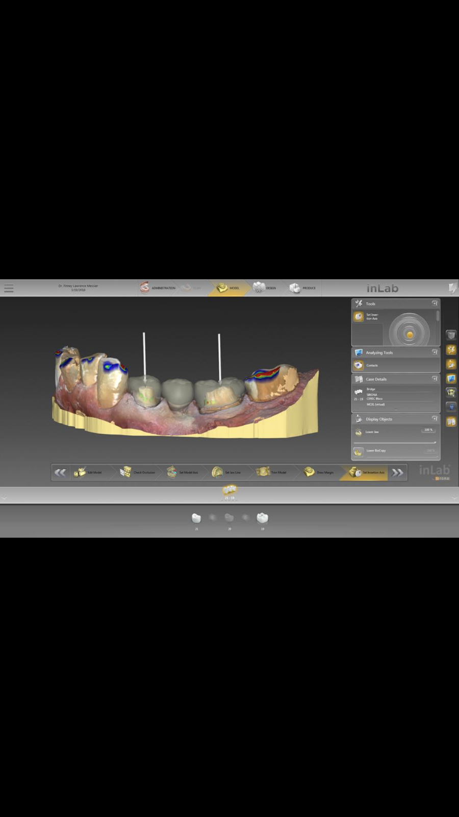 MRM DENTAL LABORATORY | 1400 S New Rd, Pleasantville, NJ 08232, USA | Phone: (609) 645-1233