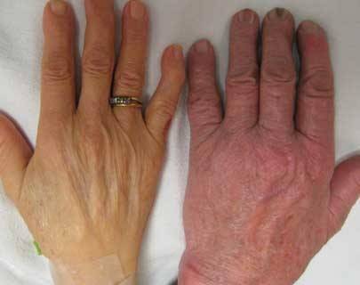 Meis Acupuncture | 7232 Sand Lake Rd Suite 201, Orlando, FL 32819, United States | Phone: (407) 624-4674