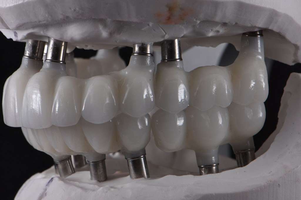 Core Dental Studio | 7372 Walnut Ave suite x, Buena Park, CA 90620, USA | Phone: (657) 239-0077