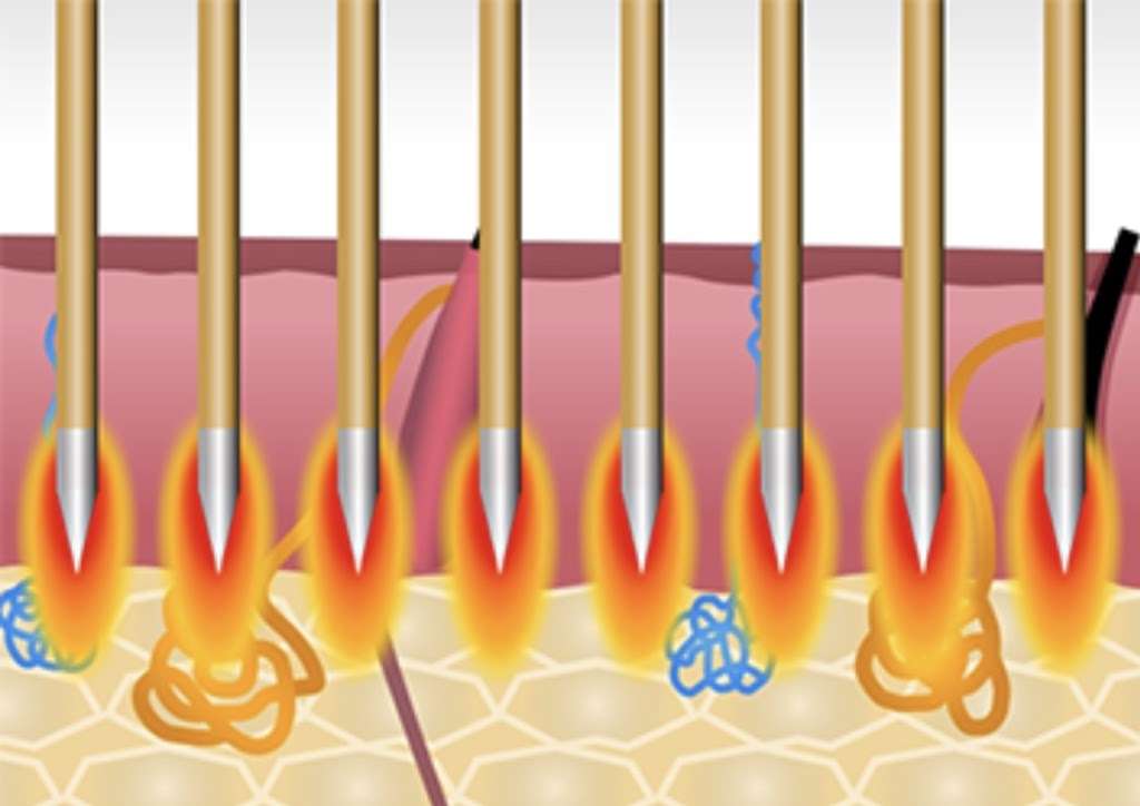 Optimcurea Face Body Aesthetic Solutions | 12234 Shadow Creek Pkwy Suite 5104B, Pearland, TX 77584, USA | Phone: (281) 764-8594