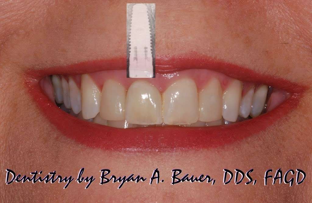 Dr. Bryan Bauer, DDS, FAGD | 623 S Naperville Rd, Wheaton, IL 60187, USA | Phone: (630) 665-5550