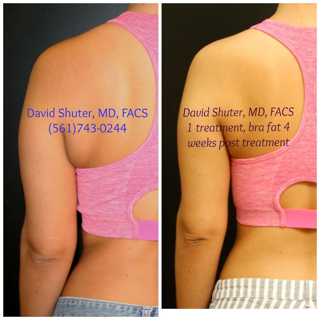 Dr. David Shuter, MD, FACS | 2151 South, FL A1AAlt suite 1000, Jupiter, FL 33477, USA | Phone: (561) 743-0244