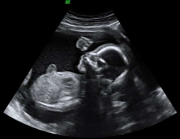 Amazing Baby 3D 4D Ultrasound | 7400 Louis Pasteur Dr Suite 106, San Antonio, TX 78229, USA | Phone: (210) 660-7337