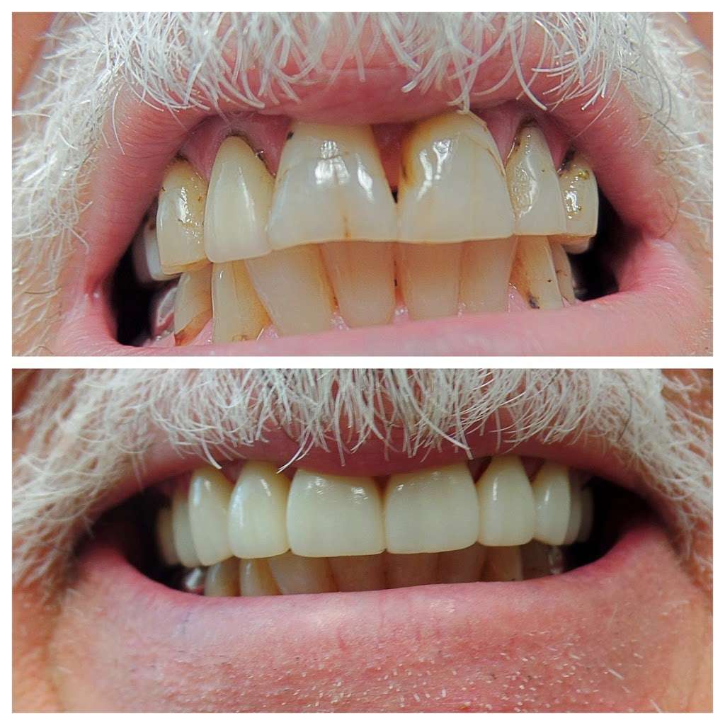 Platinum Smiles Family Dentistry | 4510 OHara Ave C, Brentwood, CA 94513, USA | Phone: (925) 634-9118
