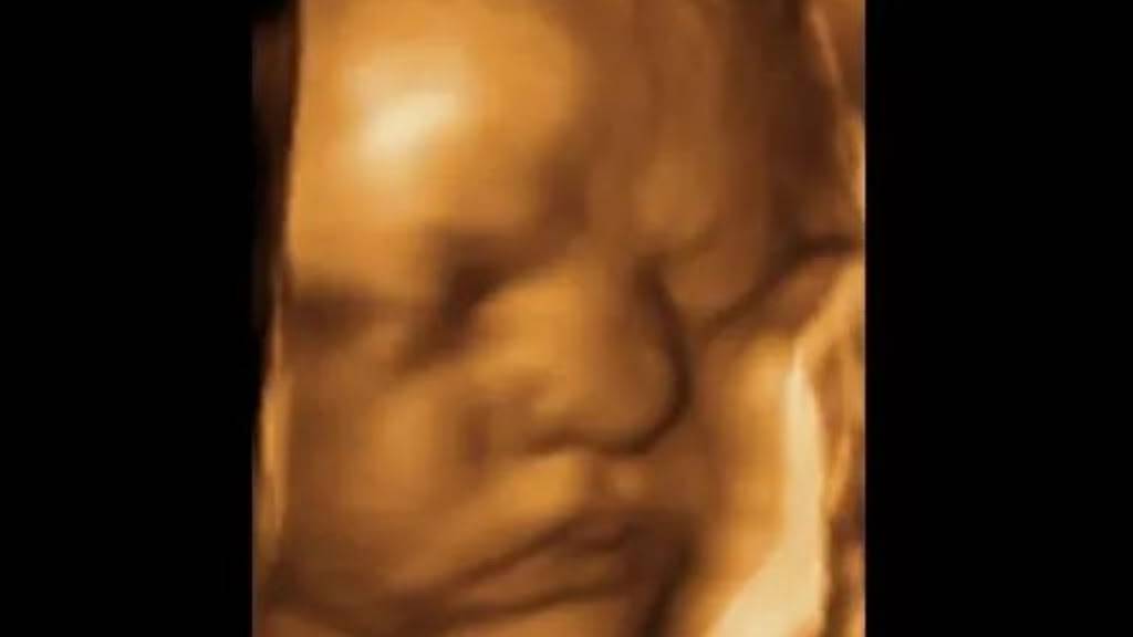 Fetal Memories 2D 3D 4D Ultrasound | 1018 N Tustin St, Orange, CA 92867 | Phone: (714) 769-2229