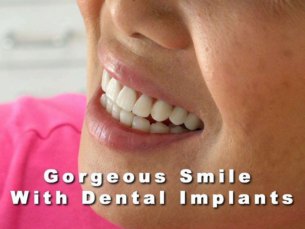 Leon F. Gerard, DDS, PA | 315 SE Mizner Blvd, Boca Raton, FL 33432, USA | Phone: (561) 338-5005