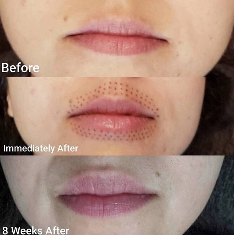 Uplift Skin Refinery | Orlando Skin Tightening | Nonsurgical Pla | 900 Fox Valley Dr Suite #100, Longwood, FL 32779, USA | Phone: (407) 564-6624