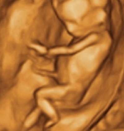 My First Peekaboo Ultrasound | 10101 W Greenfield Ave Ste 160, Milwaukee, WI 53214, USA | Phone: (414) 471-6500