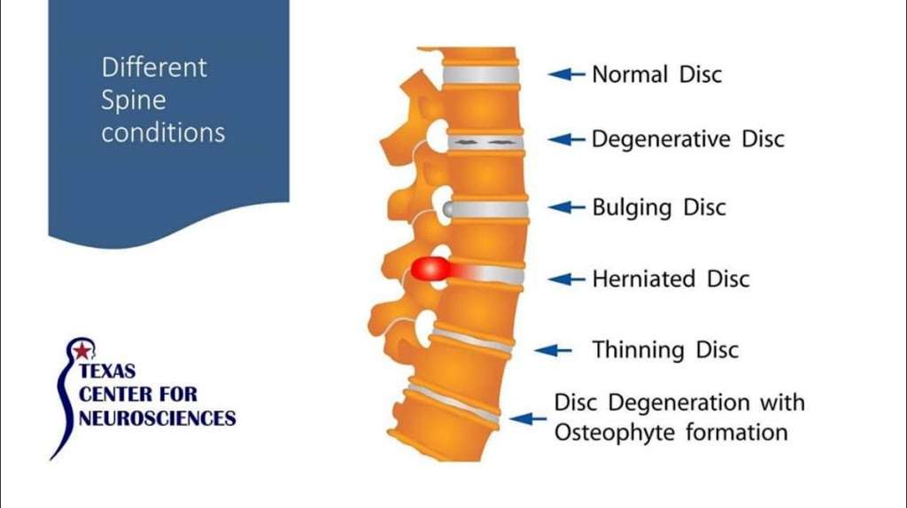 Texas Center for Neurosciences | 4141 Southwest Fwy #490, Houston, TX 77027, USA | Phone: (832) 932-9300