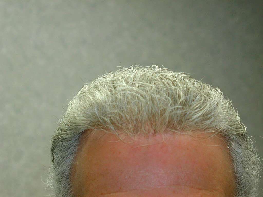 Manny Roberts Hair Replacement | 4 Expy Plaza Ll14, Roslyn Heights, NY 11577 | Phone: (800) 456-4247