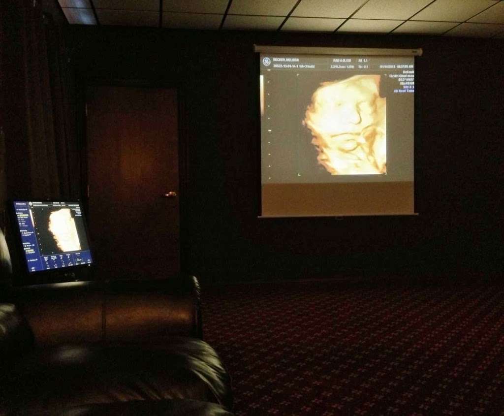 My First Peekaboo Ultrasound | 10101 W Greenfield Ave Ste 160, Milwaukee, WI 53214, USA | Phone: (414) 471-6500