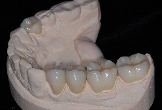 Lloyd Dental Laboratories | 500 Wilson Pike Cir UNIT 300, Brentwood, TN 37027, USA | Phone: (615) 373-1202