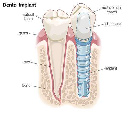 Premier Dental Care | 3005 E Palmdale Blvd, Palmdale, CA 93550, USA | Phone: (661) 273-6565