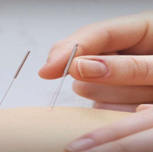 New Vision Acupuncture & Herbs | 489 NY-32, Highland Mills, NY 10930, USA | Phone: (845) 928-8689