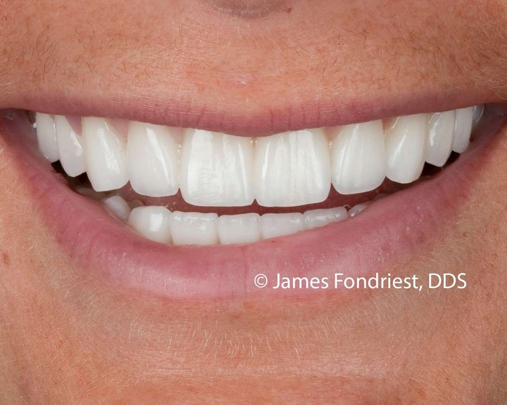 James Fondriest DDS, FACD, FICD | 560 Oakwood Ave #200, Lake Forest, IL 60045, USA | Phone: (847) 234-0517