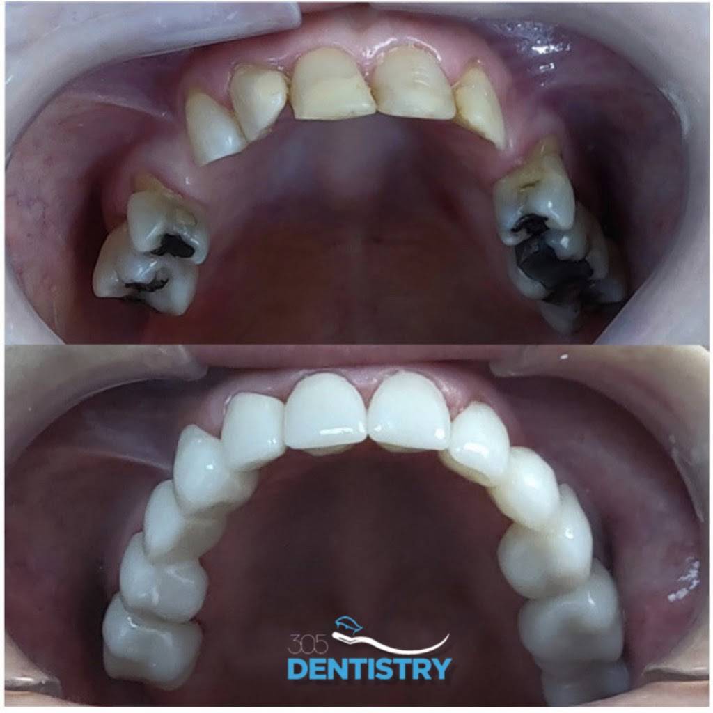 305 Dentistry | 3850 SW 87th Ave #101, Miami, FL 33165 | Phone: (305) 226-8236