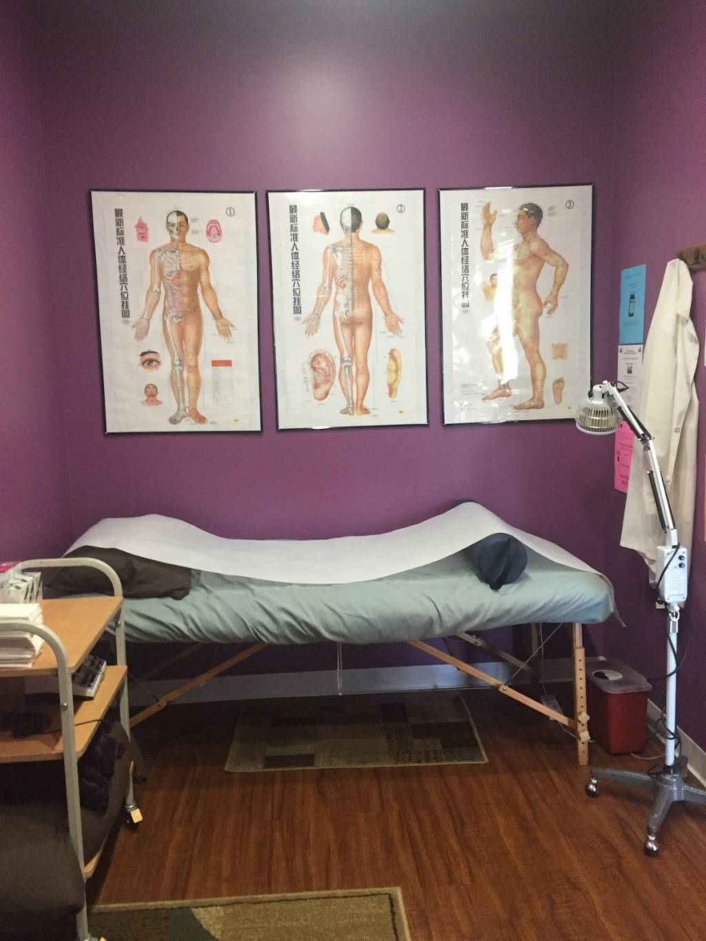 Acupuncture by Robbie Butler, L.Ac. | 4754 N French Rd, East Amherst, NY 14051, USA | Phone: (716) 688-8815